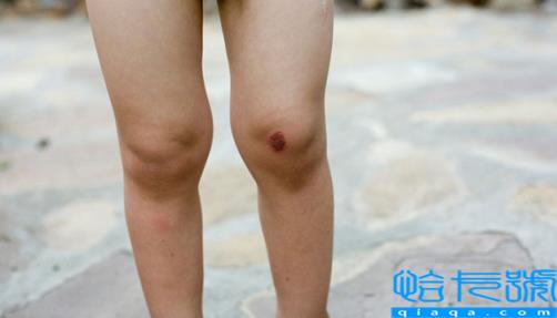 秃噜皮了什么意思(卡秃噜皮了什么意思)