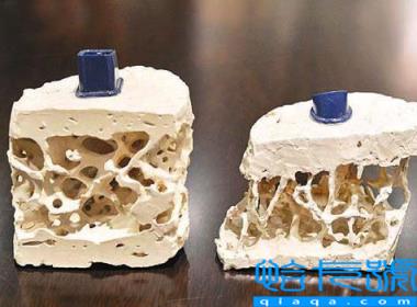 一个鸡蛋含有多少钙质（吃什么蔬菜最补钙）