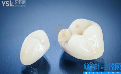 2022最新国产、进口种植牙价格表